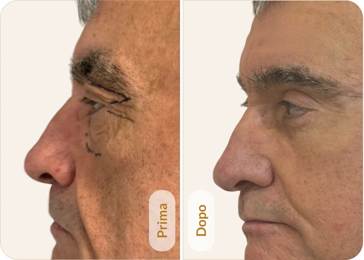 Risultato 2